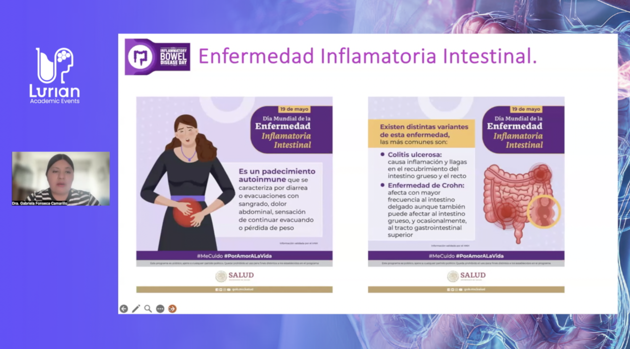 Mecanismos fisiopatológicos de la Enfermedad Inflamatoria Intestinal
