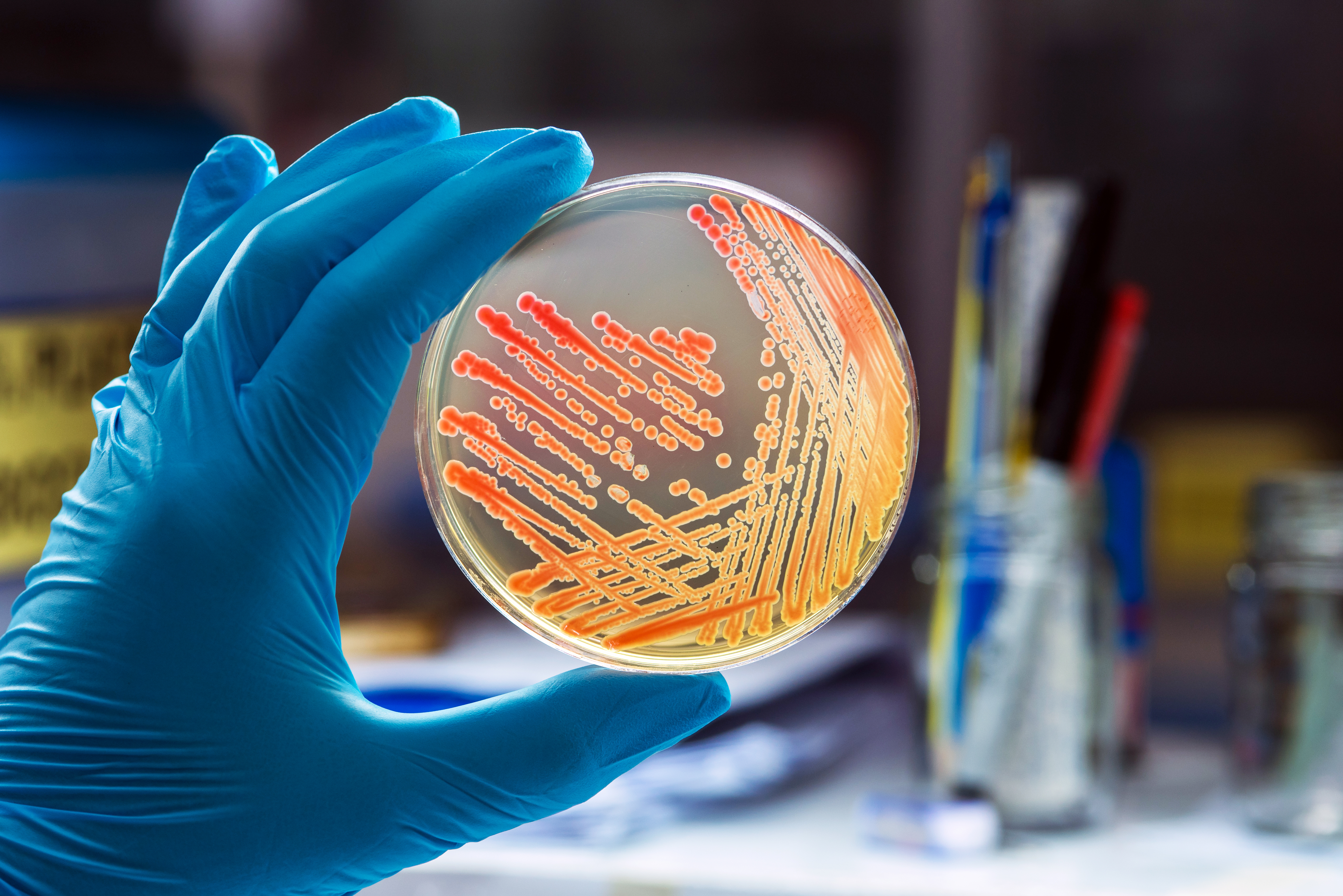 Bacteriología y Microbiología